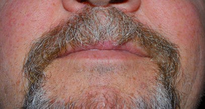 What is Beard Drift?